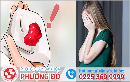 Dấu Hiệu Gây Sảy Thai Là Gì?