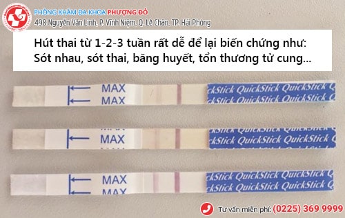 Hút thai 1 tuần, hút thai 2 tuần, hút thai 3 tuần có được không?