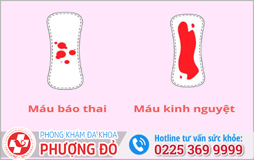 Những Điều Cần Biết Về Máu Báo Thai