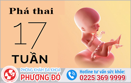 Phá Thai 17 Tuần Bằng Phương Pháp Nào An Toàn?