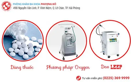 Phương pháp điều trị rong kinh Phương pháp điều trị rong kinh