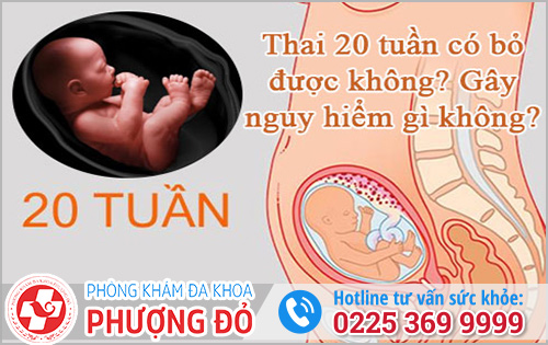 Thai 20 Tuần Tuổi Phá Có Được Không?