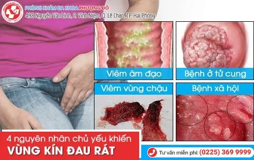 Tại sao chị em bị vùng kín đau rát?